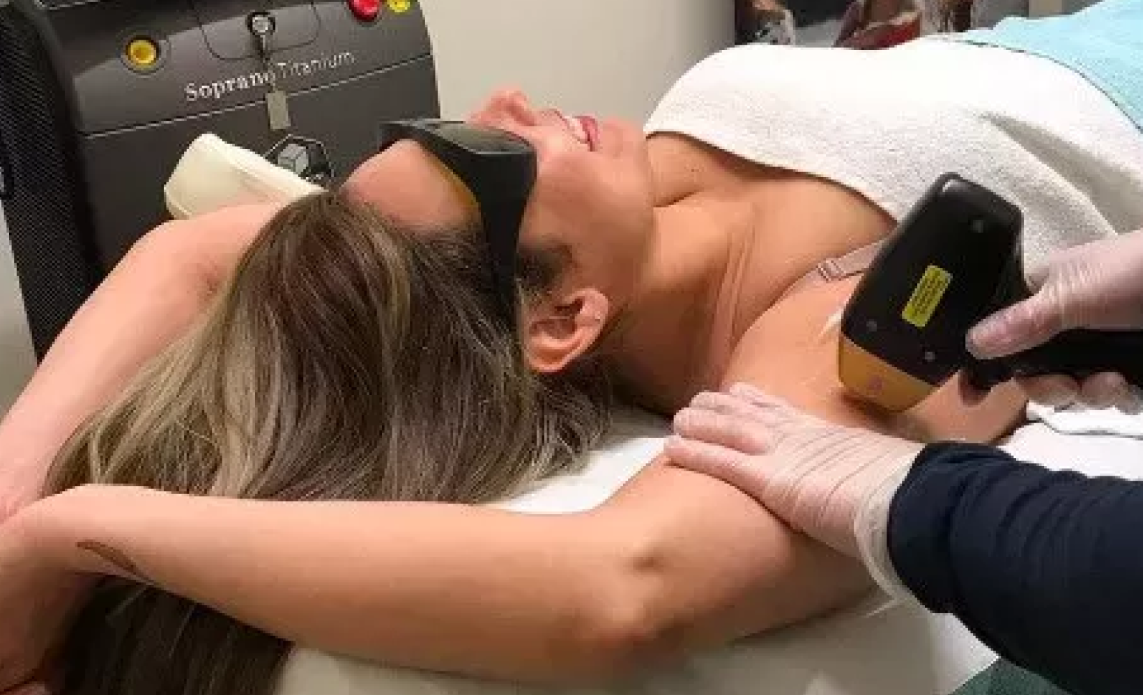 Woman receiving professional laser hair removal treatment on underarm at Skinneon clinic, technician applying Soprano laser handpiece with protective eyewear